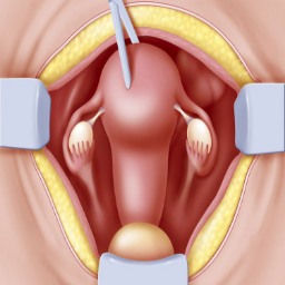 Abdominal Surgery
