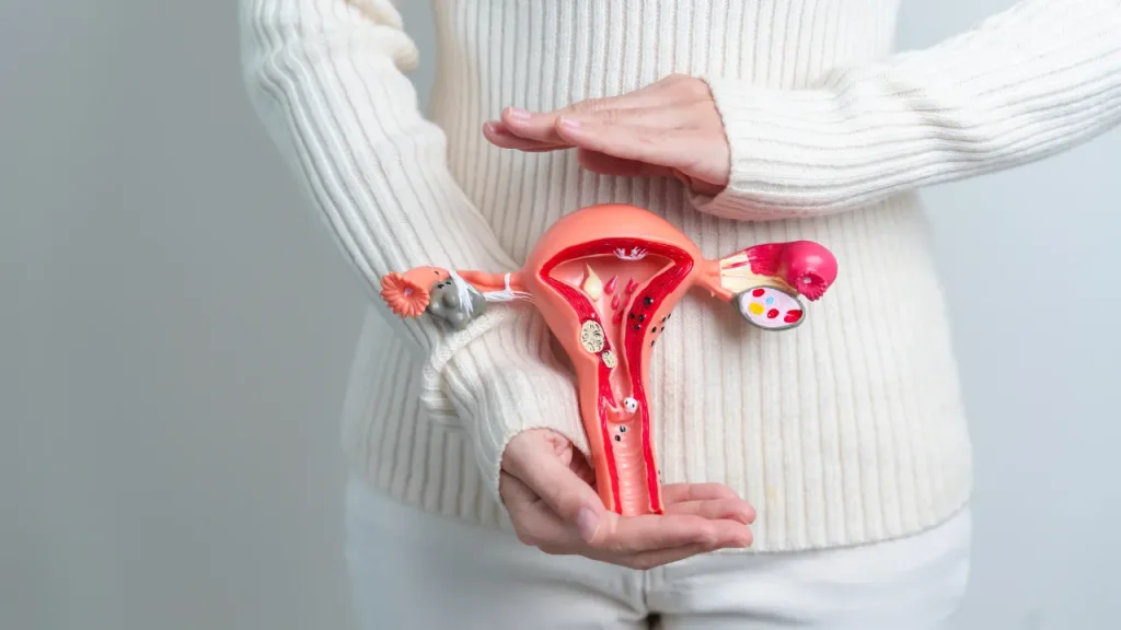 hystrectomy image